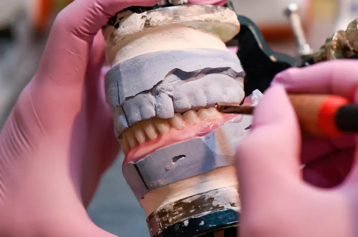 prostodoncia-dientes